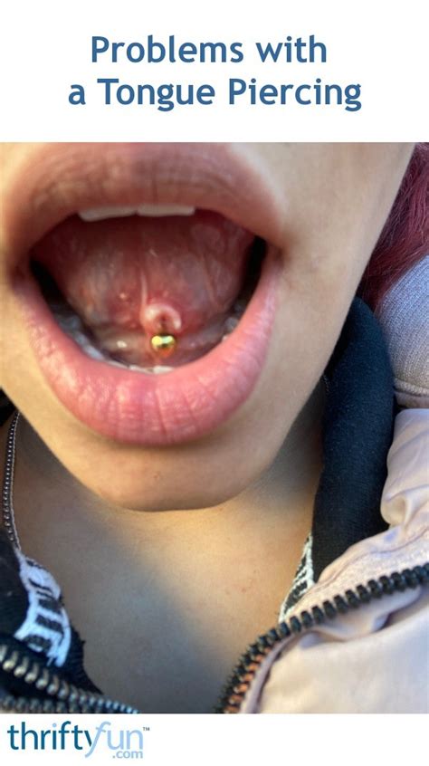 Problems with a Tongue Piercing? | ThriftyFun