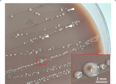 Prevotella histicola colony morphology on Schaedler KV agar with 5 % ...