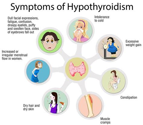 #doctor suggested treatment for #hypothyroidism - #health #tips - scoopnest.com