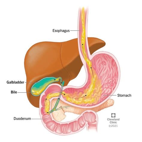 Bile - Definition and Examples - Biology Online Dictionary