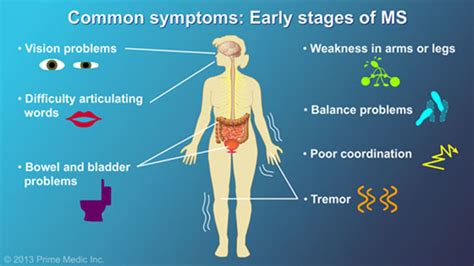 Multiple Sclerosis Clinical Features Diagnosis And Ma - vrogue.co