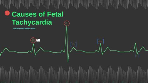 Causes of Fetal Tachycardia by Caroline Epstein