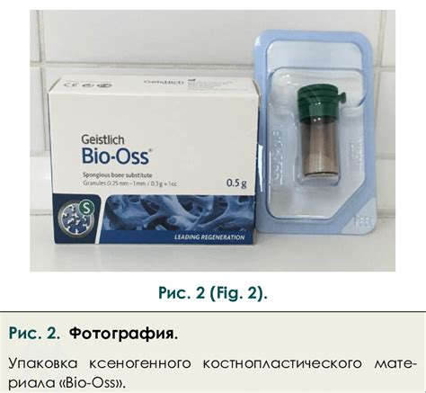 Photo. Packing of xenogenic bone graft «Bio-Oss». | Download Scientific ...