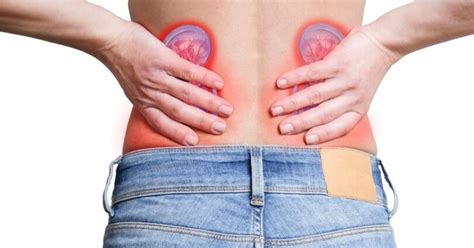 How to tell the difference between kidney pain and lower back pain - Best Recipes