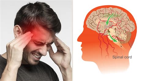 Science Explains What Happens in the Brain During a Migraine