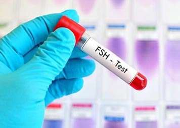 Follicle Stimulating Hormone Test (FSH): Functions & Levels