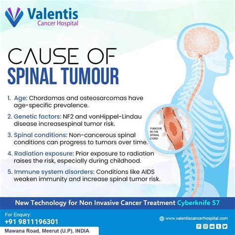 Understanding Spinal Tumors: Types, Classification, and Causes | by Valentis cyberknife centre ...