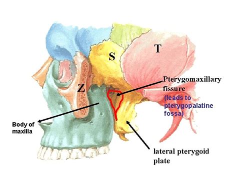 Infratemporal Fossa Boundaries of Infratemporal fossa Temporomandibular joint