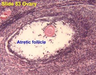 Atresia and Ovulation Flashcards | Quizlet