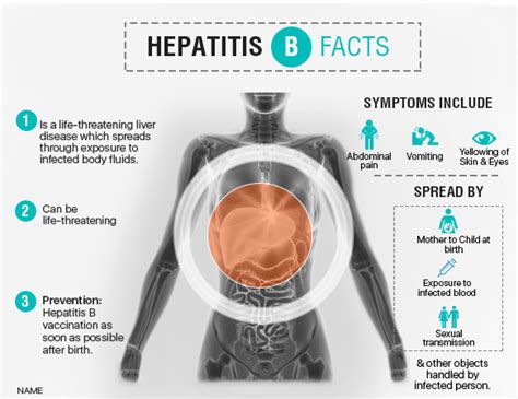 Hepatitis B: Symptoms, Diagnosis and Treatment | Dr. Vivek Vij