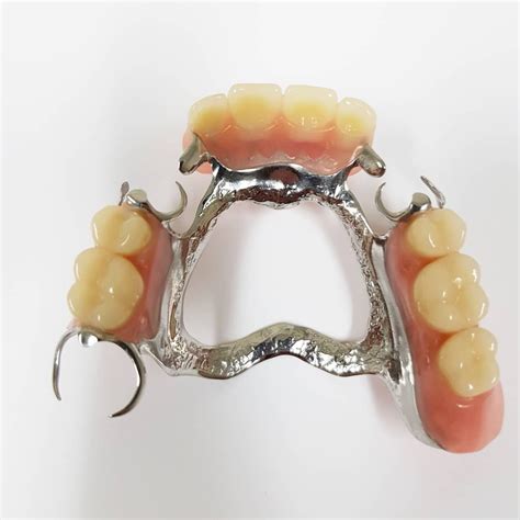 Partial Dentures Metal | Dentagama