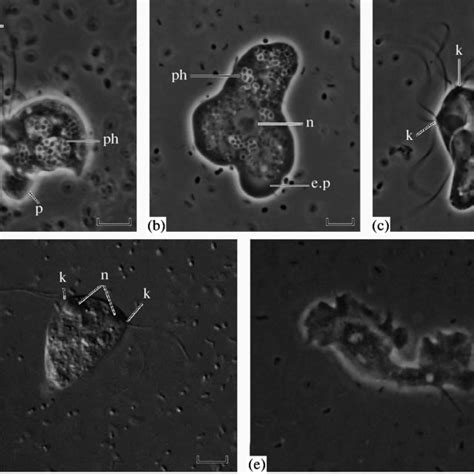 Morphology of the flagellated cells, the amoeboid cells and the cysts... | Download Scientific ...