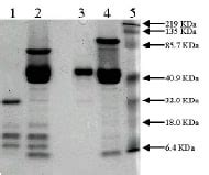 Recombinant mouse Urokinase protein (ab92641) | Abcam