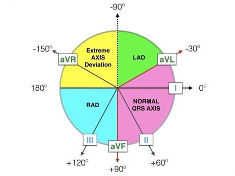 ECG Axis. Method 3 – The Isoelectric Lead. Cardiology Nursing, Cardiac ...