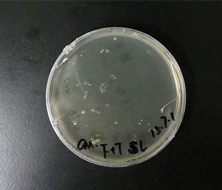 Team:Amoy/Notebook - 2015.igem.org