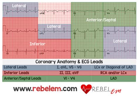 Dr. Smith's ECG Blog