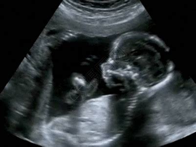 第四个月胎儿四月的超声波地理学高清图片下载-正版图片502553655-摄图网