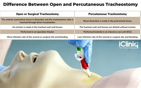 Tracheostomy Procedure