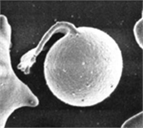 Pyknocyte | eClinpath