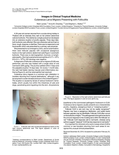 (PDF) Cutaneous Larva Migrans Presenting with Folliculitis