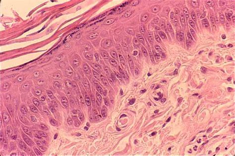 Epidermis Histology