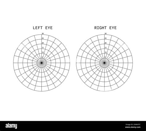 Amsler test grid. Eye scotoma chart. Oculist Vector printable chart retina examination. Grid ...