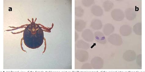 [PDF] An atypical case of Babesia bigemina parasitising a dog from a ...