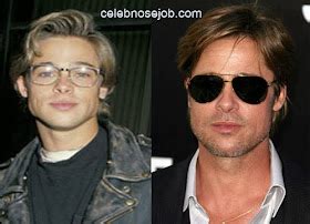 Celebrity Plastic Surgery Photos: Brad Pitt Botox and Facial Fillers ...