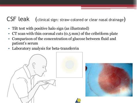 Clinical Evaluation in Maxillofacial Trauma