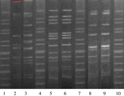 PFGE fingerprints of three pairs of clinical A. baumannii isolates... | Download Scientific Diagram