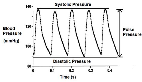 Pulse pressure definition, wide pulse pressure & narrow pulse pressure causes