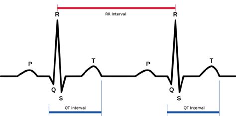 Analsis del Intervalo QT | Como calcular el Intervalo QTc