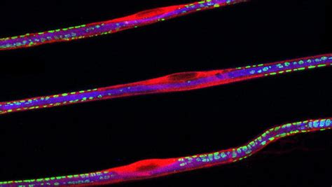 Schwann Cells