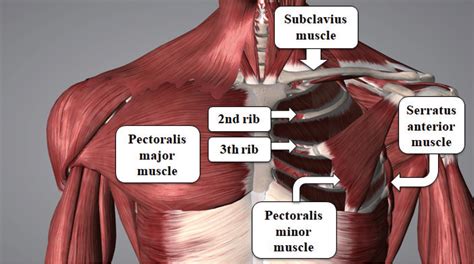 How to Use Pectoral Nerve Blocks Effectively-An Evidence-Based Update | AJA Asian Journal of ...