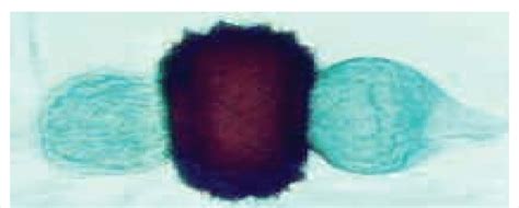 Zygospore formation. | Download Scientific Diagram