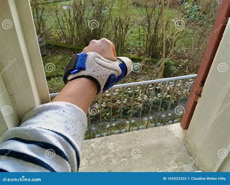 Sprained Thumb in Medical Splint Stock Image - Image of open, medical: 169523325