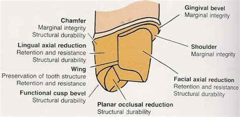 PFM (Posterior) Crown Restorations : restorative Dentistry Lecture note ~ Dentistry and Medicine