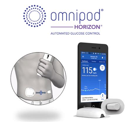 Omnipod Horizon Deutschland - armband deutschland