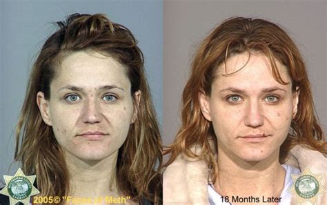 Meth Addicts: Before and After (38 pics) - Izismile.com