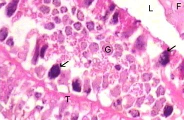 A section of the venom gland of Androctonus amoreuxi Scorpion showing... | Download Scientific ...