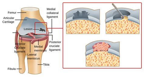 5 Ways to Make Tissue Engineering a More Approachable Topic for Students