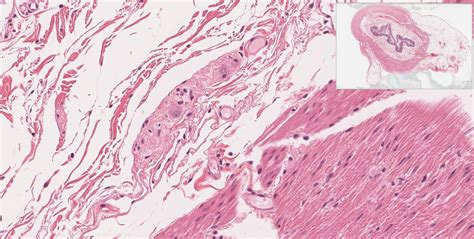 Peripheral Nervous System | histology