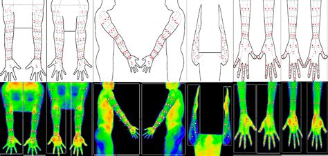 Figure 1 from Reference Standards for Digital Infrared Thermography Measuring Surface ...