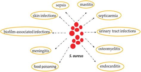 Staphylococcus Aureus Antibiotic