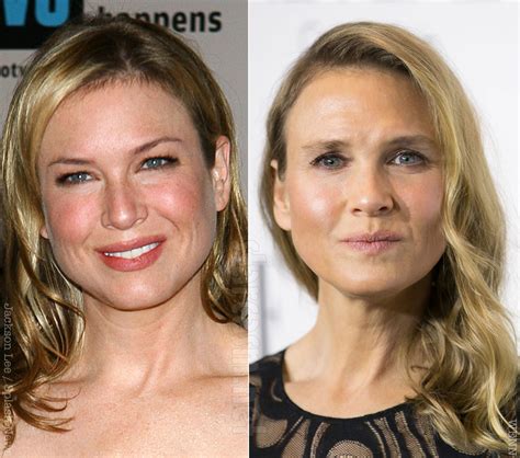 Renee Zellweger calls plastic surgery rumors a nefarious truth