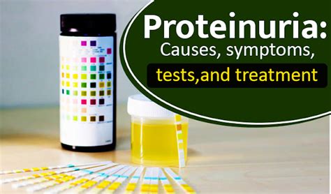 Proteinuria: Causes, symptoms, tests, and treatment - Karma Ayurveda Health Hospital