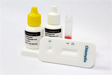 Chlamydia: diagnosis and treatment - bigman lab