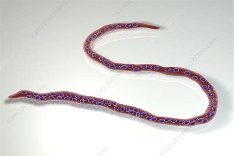 Onchocerca volvulus parasitic worm, illustration - Stock Image - F022/1885 - Science Photo Library