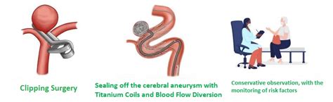 CEREBRAL ANEURYSM - Overview and Treatments - HKBSSP