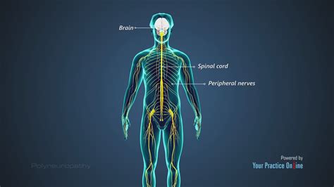 What Is Polyneuropathy